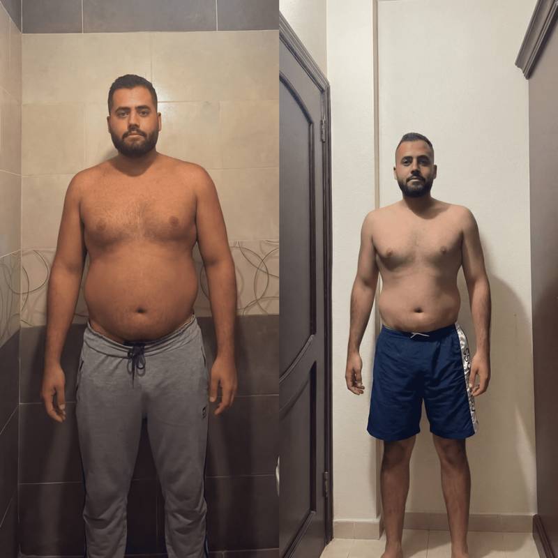 Before and after