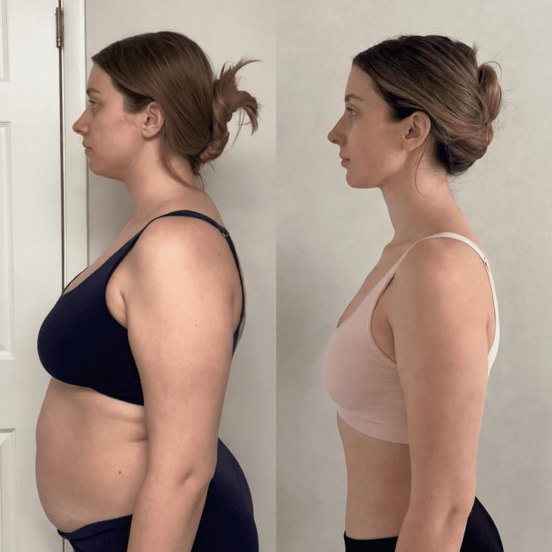 Before and after
